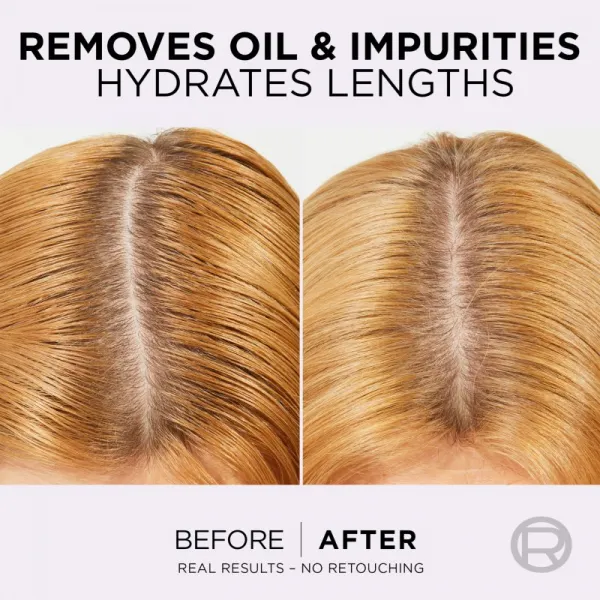 L’Oréal Paris Elseve Hyaluron Pure balzam na vlasy pre mastnú vlasovú pokožku a suché končeky 300 ml