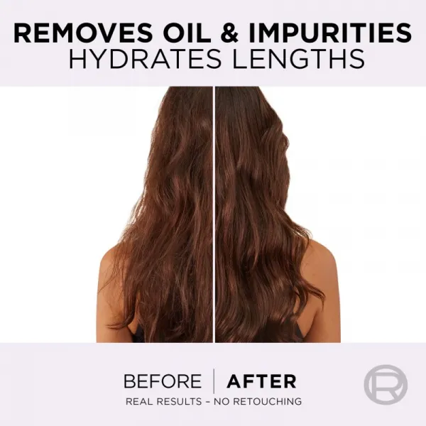 L’Oréal Paris Elseve Hyaluron Pure hĺbkovo čistiace sérum pre vlasovú pokožku 102 ml