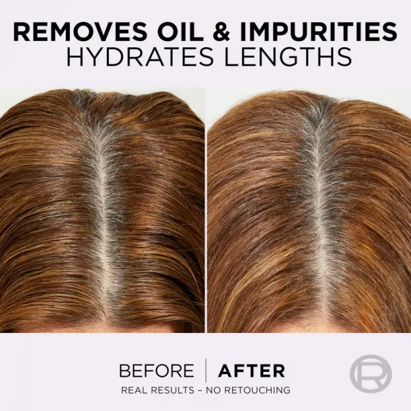 L’Oréal Paris Elseve Hyaluron Pure balzam na vlasy pre mastnú vlasovú pokožku a suché končeky 300 ml