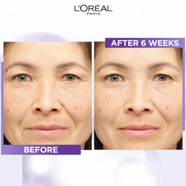 L’Oréal Paris Revitalift Filler sérum proti vráskam s kyselinou hyalurónovou 15 ml