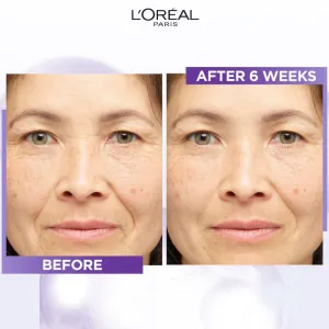 L’Oréal Paris Revitalift Filler sérum proti vráskam s kyselinou hyalurónovou 15 ml