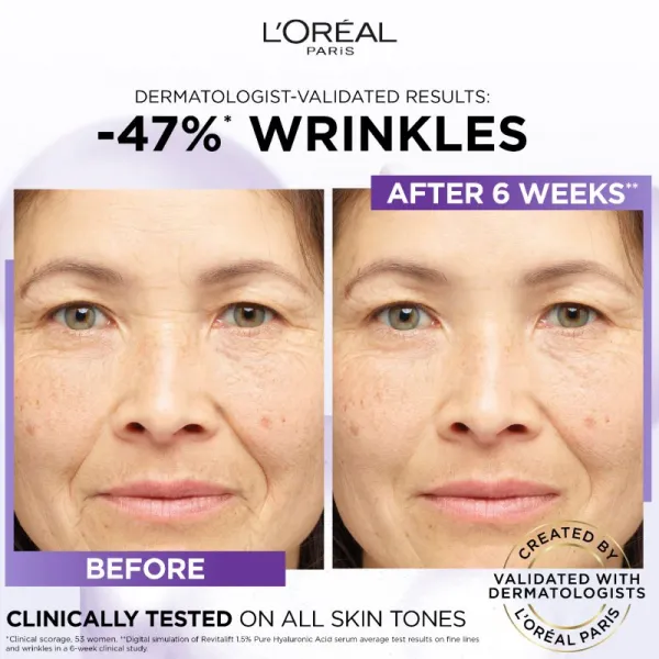 L’Oréal Paris Revitalift Filler sérum proti vráskam s kyselinou hyalurónovou 15 ml