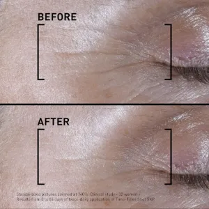 FILORGA TIME-FILLER SHOT intenzívne sérum proti prvým známkam starnutia pleti 15 ml