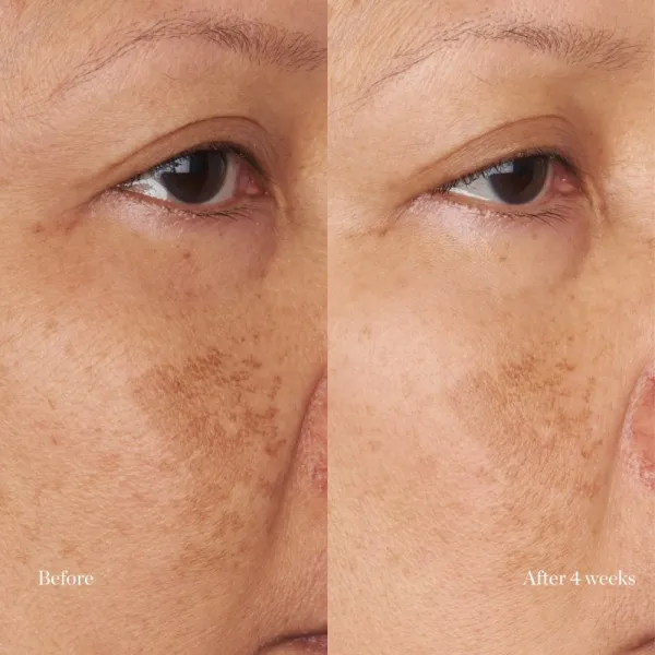 Perricone MD Hypoallergenic Clean Correction Moisturizer hydratačný a vyživujúci krém 59 ml