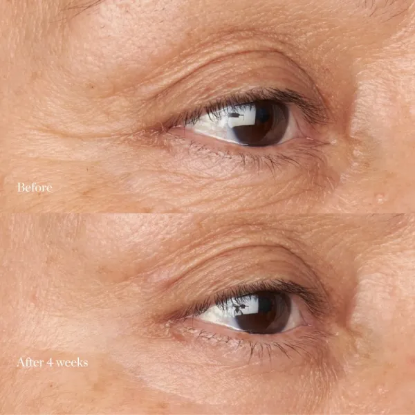 Perricone MD Hypoallergenic Clean Correction Eye Cream hydratačná a rozjasňujúca starostlivosť na očné viečka a kruhy pod očami 15 ml