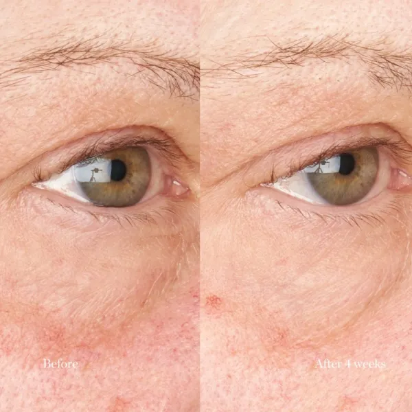 Perricone MD Hypoallergenic Clean Correction Eye Cream hydratačná a rozjasňujúca starostlivosť na očné viečka a kruhy pod očami 15 ml