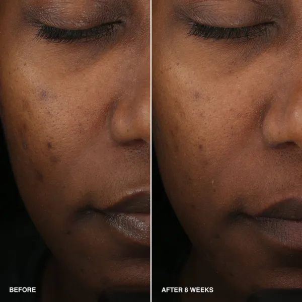 Bobbi Brown Vitamin Enriched Smoothing Serum rozjasňujúce sérum s vitamínom C 30 ml