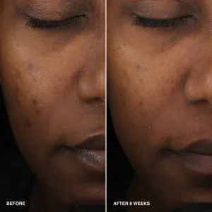 Bobbi Brown Vitamin Enriched Smoothing Serum rozjasňujúce sérum s vitamínom C 30 ml