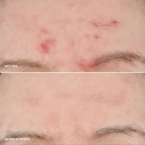 Bobbi Brown Vitamin Enriched Smoothing Serum rozjasňujúce sérum s vitamínom C 30 ml