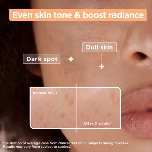 Mixa Sensitive Skin Expert sérum proti pigmentovým škvrnám 30 ml