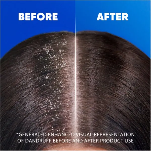 Head & Shoulders Apple Fresh šampón proti lupinám 500 ml