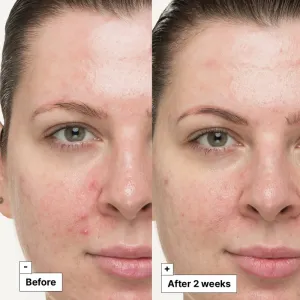 Dr. Jart+ Cicapair™ So Soothing Treatment lokálna starostlivosť neutralizuje začervenanie 30 ml