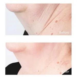 Perricone MD Cold Plasma Plus+ Sub-D/Neck spevňujúci krém na krk a dekolt 59 ml