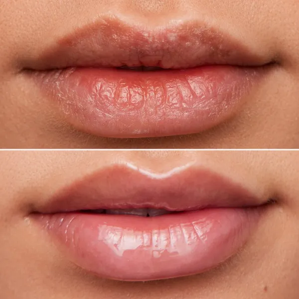 WONDERSKIN Lip Rehab Therapy Oil olej na pery s hydratačným účinkom odtieň Clear 3,57 ml