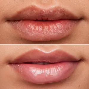 WONDERSKIN Lip Rehab Therapy Oil olej na pery s hydratačným účinkom odtieň Clear 3,57 ml