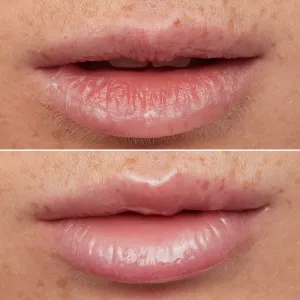 WONDERSKIN Lip Rehab Therapy Oil olej na pery s hydratačným účinkom odtieň Clear 3,57 ml