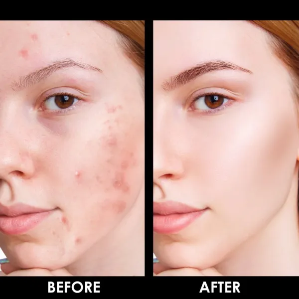 Arval Puractiva Bio-Balancing Cream čistiaci krém s regeneračným účinkom 50 ml