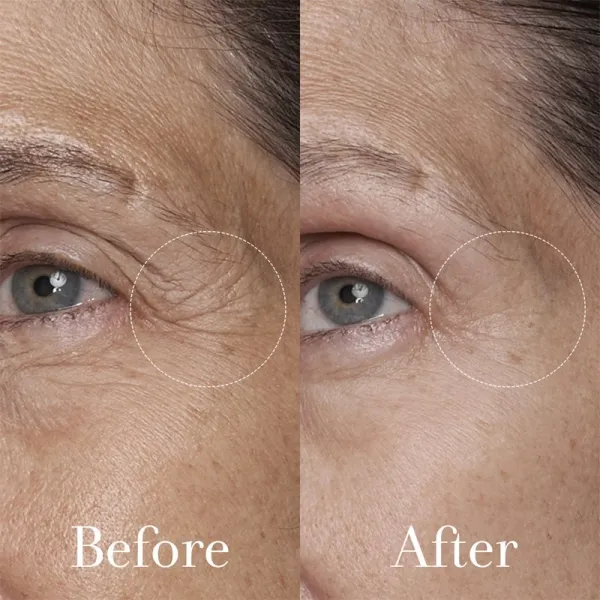 fresh Black Tea Age Renewal Eye Concentrate omladzujúci očný krém 15 ml
