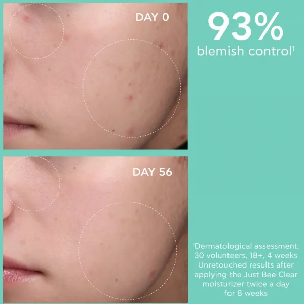 Apivita Just Bee Clear Blemish Control Moisturizer hydratačný krém na tvár s niacínamidom 40 ml