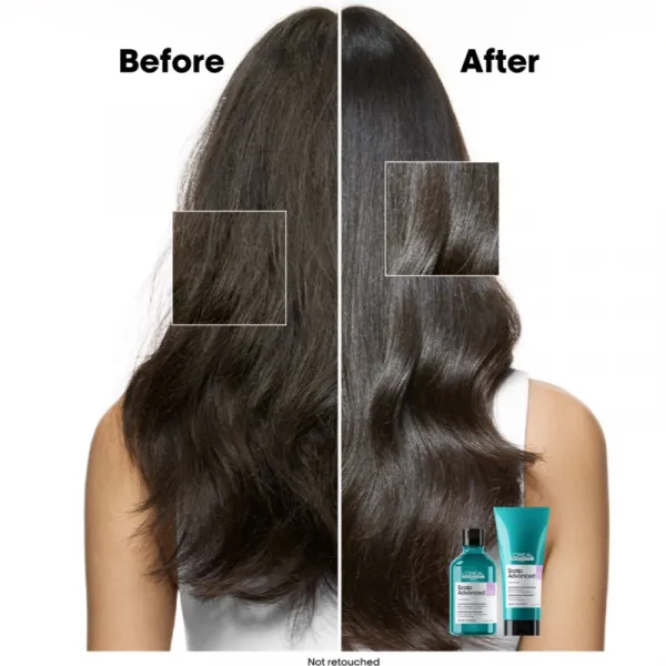 L’Oréal Professionnel Serie Expert Scalp Advanced šampón pre citlivú a podráždenú pokožku hlavy 500 ml