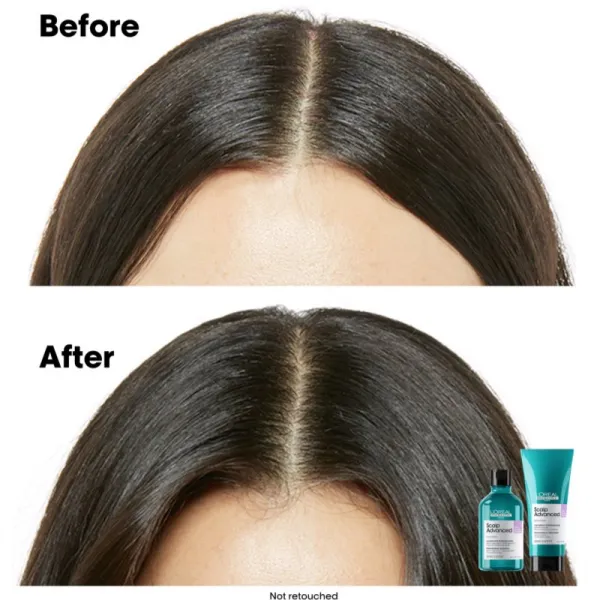 L’Oréal Professionnel Serie Expert Scalp Advanced šampón pre citlivú a podráždenú pokožku hlavy 500 ml