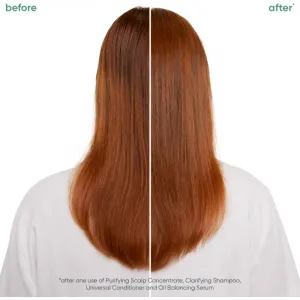 Biolage ScalpSync vlasové sérum na mastné vlasy 50 ml