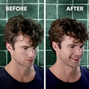 Schwarzkopf Schauma Anti-Dandruff upokojujúci šampón proti lupinám 400 ml