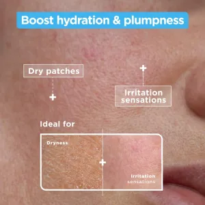 MIXA Sensitive Skin Expert upokojujúce a hydratačné sérum 30 ml