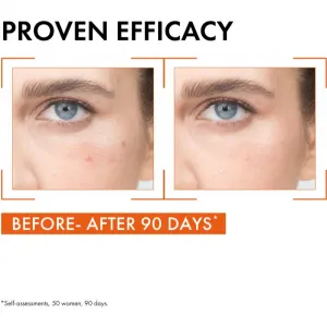 Vichy Liftactiv Supreme rozjasňujúce pleťové sérum s vitamínom C 20 ml