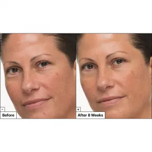 Dr. Jart+ Prejuvenation Cream with Bakuchiol regeneračný a spevňujúci krém proti príznakom starnutia 50 ml