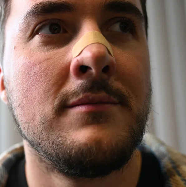 Lunesto Nasal Strips - pásky na nos 30 ks
