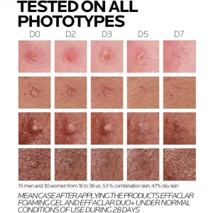 La Roche-Posay Effaclar DUO (+M) korekčná obnovujúca starostlivosť proti nedokonalostiam pleti a stopám po akné 40 ml