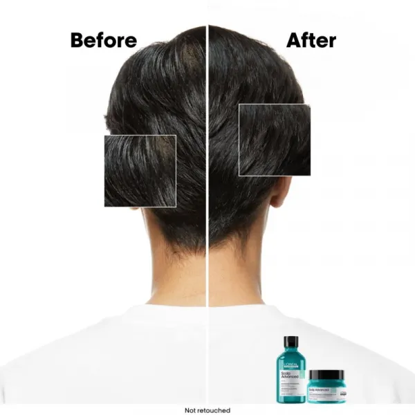 L’Oréal Professionnel Serie Expert Scalp Advanced šampón a maska 2 v 1 pre mastné vlasy a vlasovú pokožku 250 ml