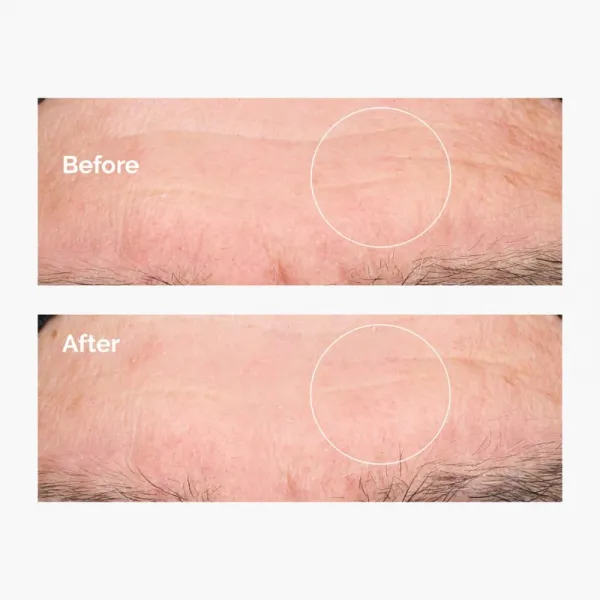 The Ordinary Hyaluronic Acid 2% + B5 hydratačné sérum s ceramidmi 60 ml