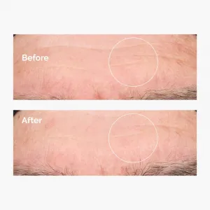 The Ordinary Hyaluronic Acid 2% + B5 hydratačné sérum s ceramidmi 60 ml