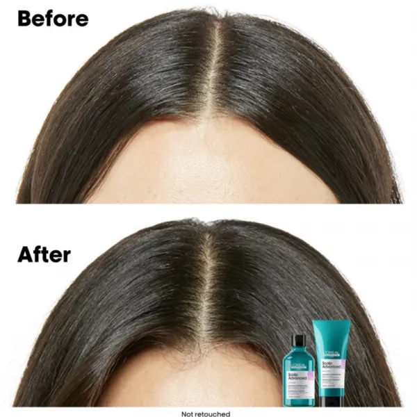 L’Oréal Professionnel Serie Expert Scalp Advanced šampón pre citlivú a podráždenú pokožku hlavy 300 ml