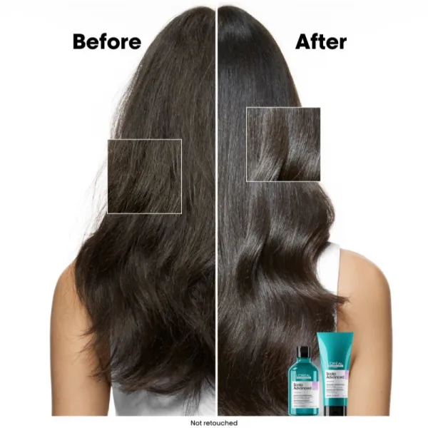 L’Oréal Professionnel Serie Expert Scalp Advanced šampón pre citlivú a podráždenú pokožku hlavy 300 ml