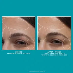 Peter Thomas Roth Peptide Skinjection™ Moisture Infusion Cream Refillable vyhladzujúci hydratačný krém s peptidmi plniteľný 50 ml