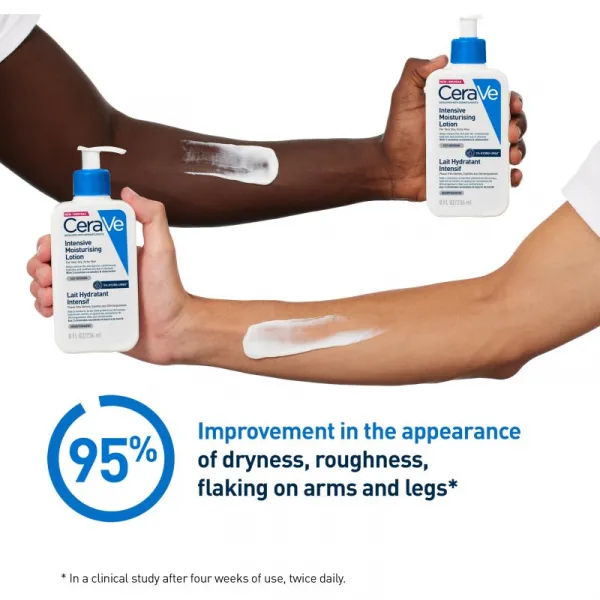 CeraVe Moisturizers Intensive Moisturizing Lotion hydratačné mlieko pre suchú pokožku so sklonom k svrbeniu 473 ml