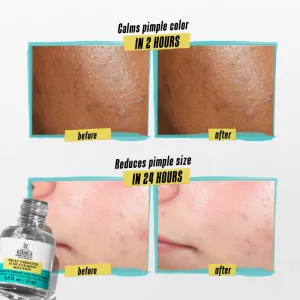 Kiehl's Dermatologist Solutions Truly Targeted Blemish-Clearing Solution sérum na aknóznu pleť pre ženy 15 ml