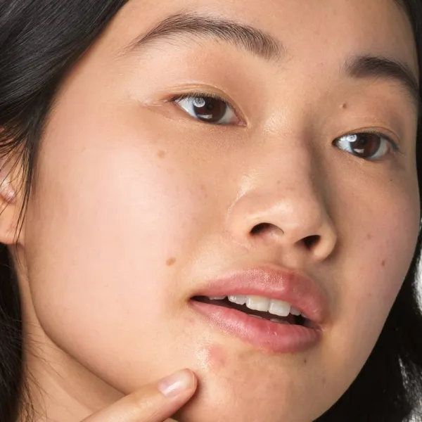 Kiehl's Dermatologist Solutions Truly Targeted Blemish-Clearing Solution sérum na aknóznu pleť pre ženy 15 ml