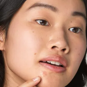 Kiehl's Dermatologist Solutions Truly Targeted Blemish-Clearing Solution sérum na aknóznu pleť pre ženy 15 ml