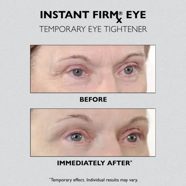 Peter Thomas Roth Instant FIRMx Eye očný krém na omladenie pleti 30 ml