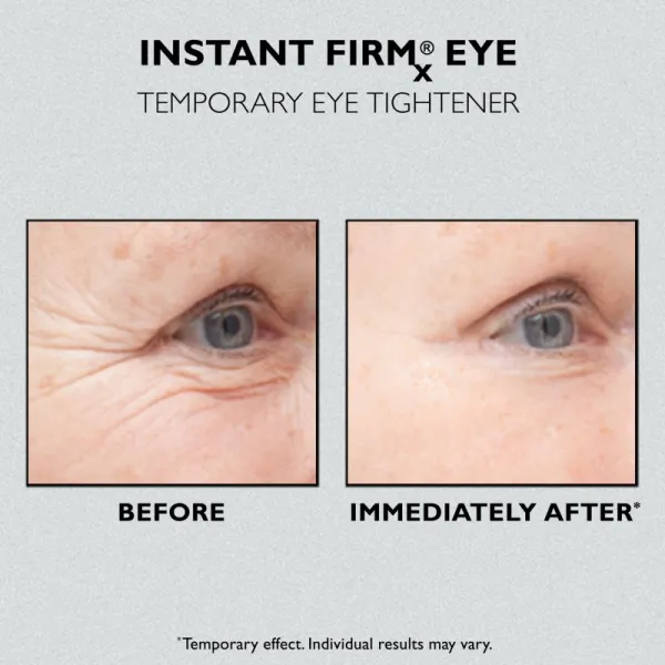 Peter Thomas Roth Instant FIRMx Eye očný krém na omladenie pleti 30 ml