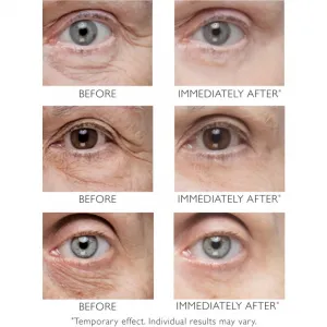 Peter Thomas Roth Instant FIRMx Eye očný krém na omladenie pleti 30 ml