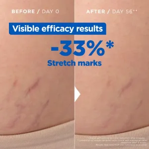 Mixa Stretch Mark Oil olej proti striám 100 ml