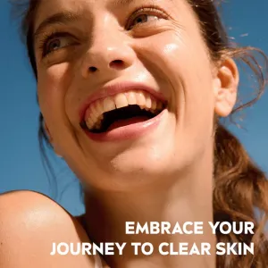 NIVEA Derma Skin Clear obnovujúce pleťové sérum pre problematickú pleť 30 ml