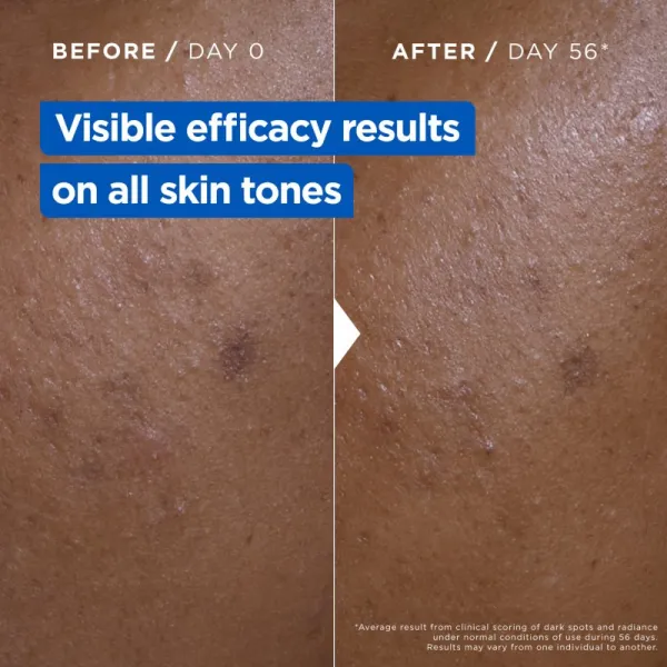 Mixa Niacinamide Bright intenzívne hydratačný krém proti tmavým škvrnám 400 ml