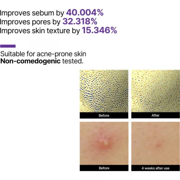 Some By Mi Retinol Intense Reactivating Serum protivráskové retinolové sérum pre citlivú pleť 30 ml