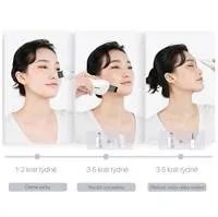 TOUCHBeauty 1887 Ultrazvuková špachtle na pleť